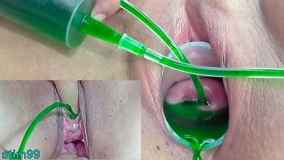 äºšæ´²å¥³åŒæ€§æ‹è€…çš„å­å®«é¢ˆå’Œå°¿ä»–å¦ˆçš„æ´žæ³¨å°„å……æ°”